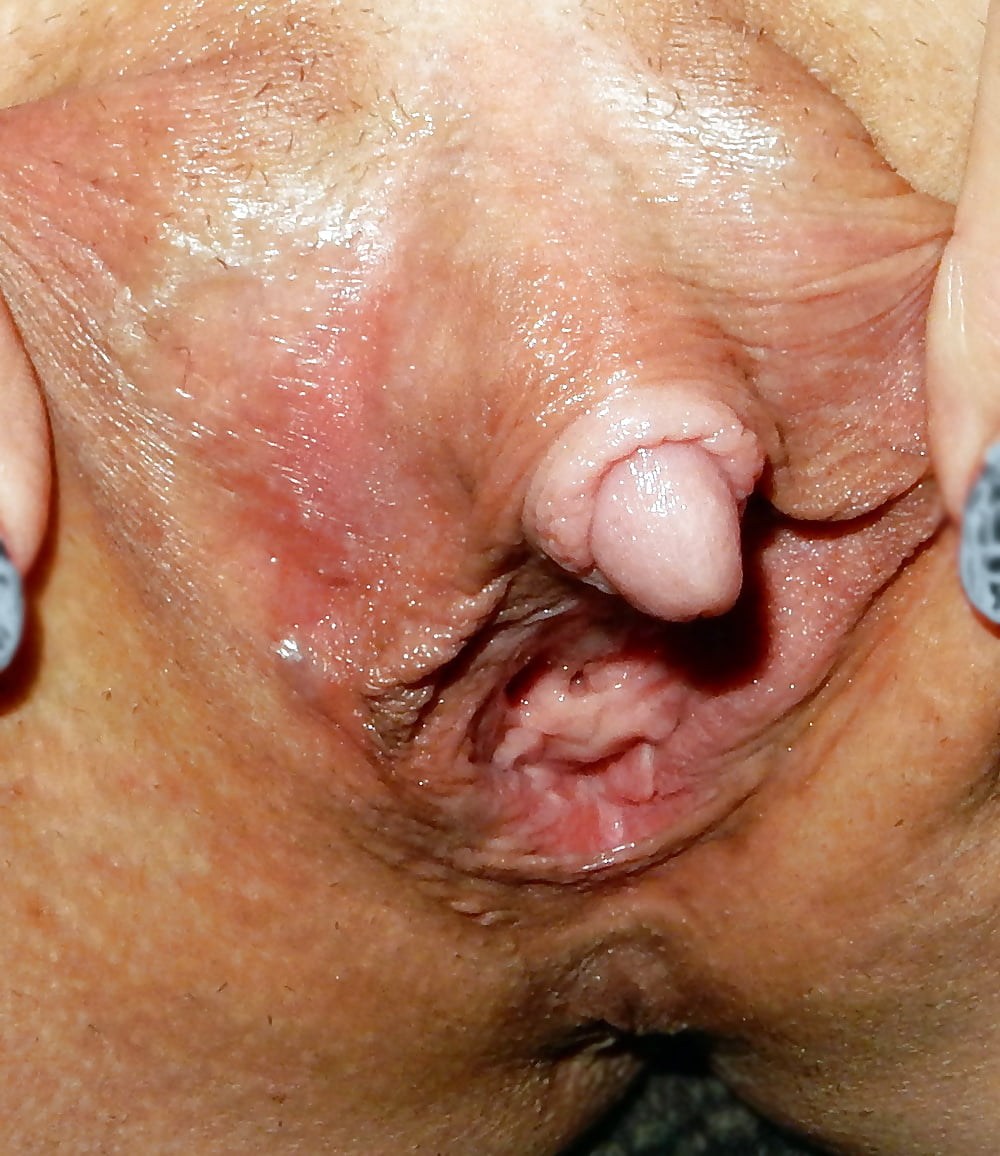 Вагина женская больная