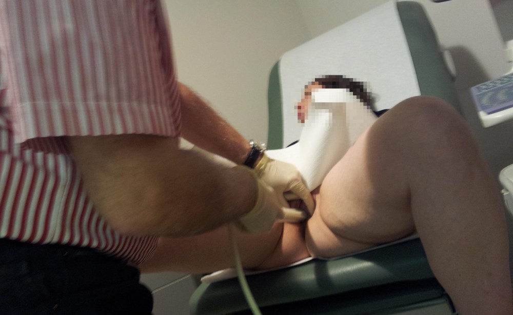 Трах в кресле гинеколога