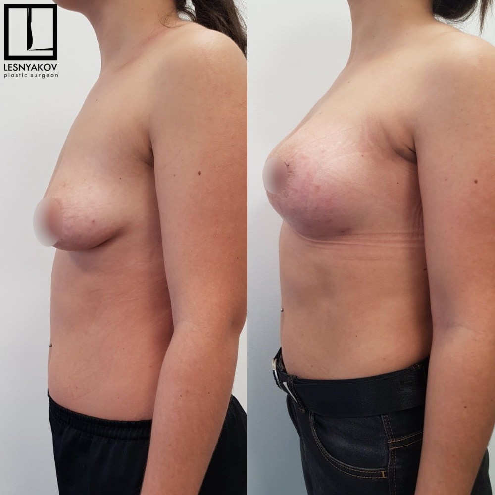 Огромные сиськи без сосков