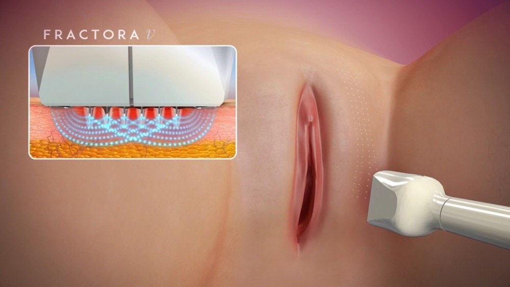 Красивый транс пост ОП