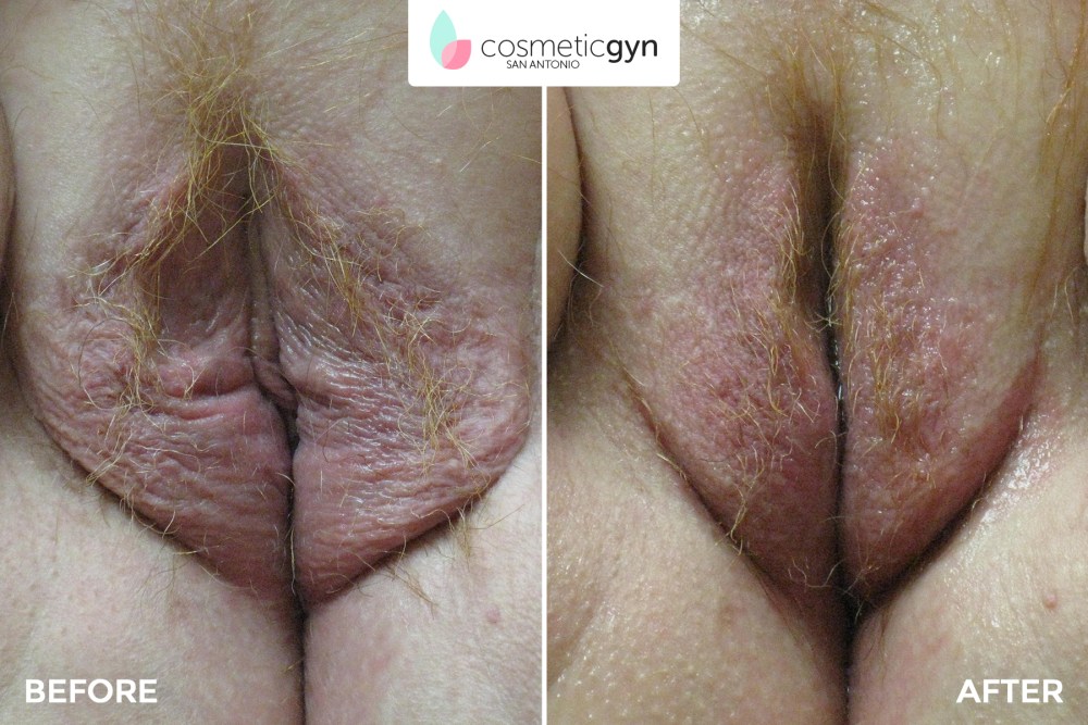 Девушки с членом и влагалищем