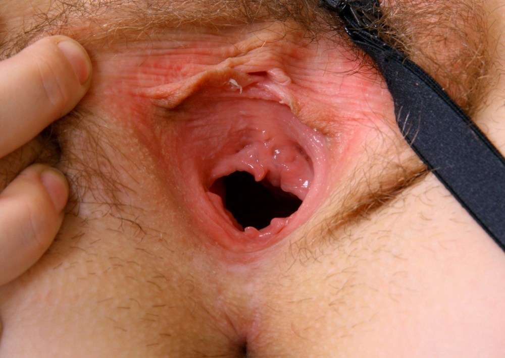 Маленький отросток во влагалище