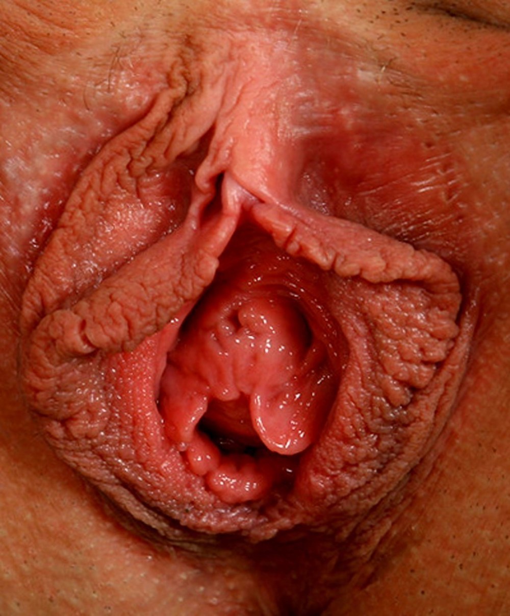 Строение женской вагины