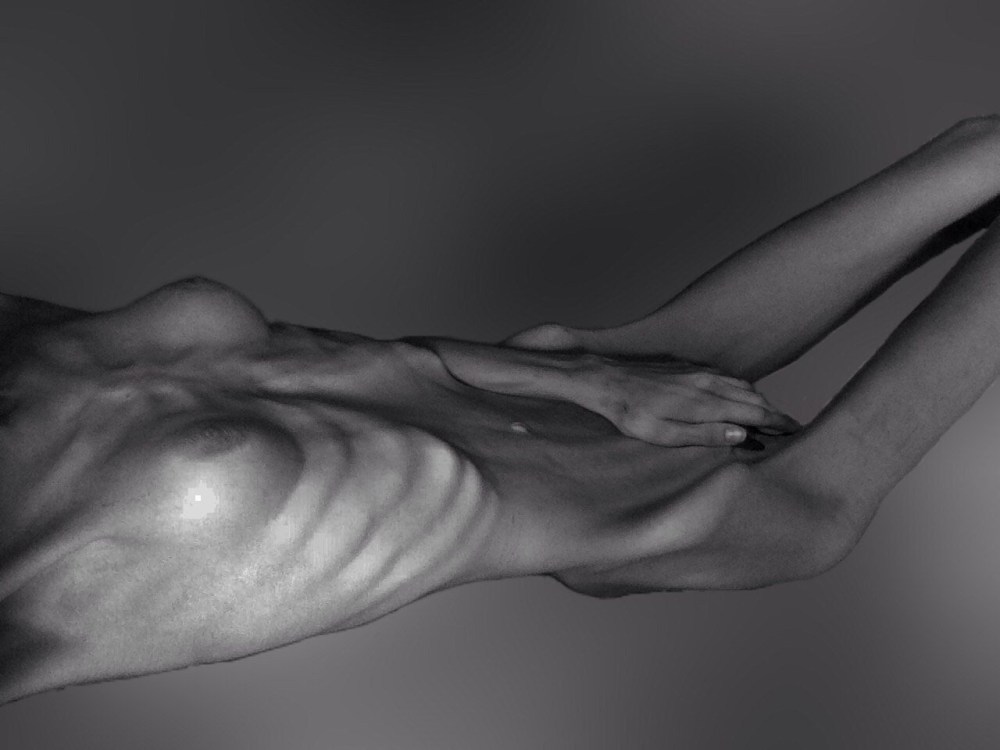 Анал тощие Анорексички