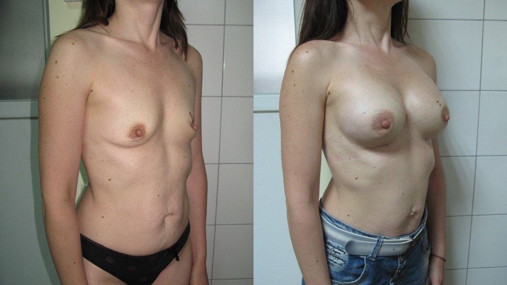 Девчонки голые с нулевой грудью