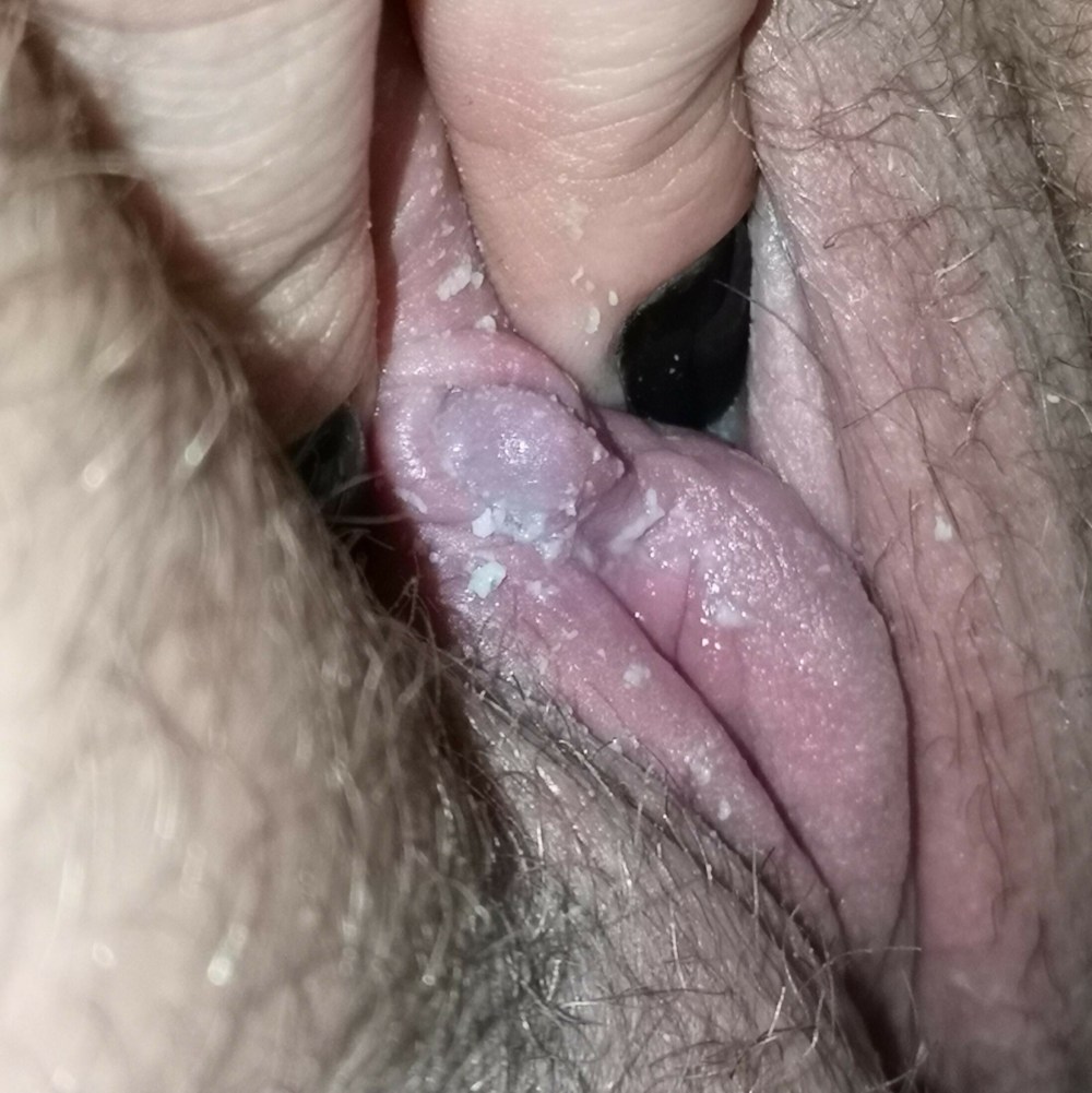 Unwashed pussy has Major smegma discharge