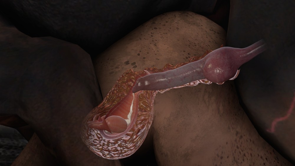 3d XRAY оплодотворение urethra